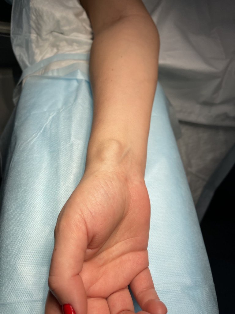 Удаление гигромы_1.jpg Удаление гигромы_1.jpg