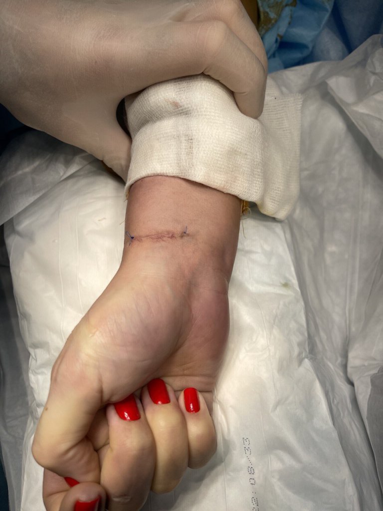 Удаление гигромы_2.jpg Удаление гигромы_2.jpg